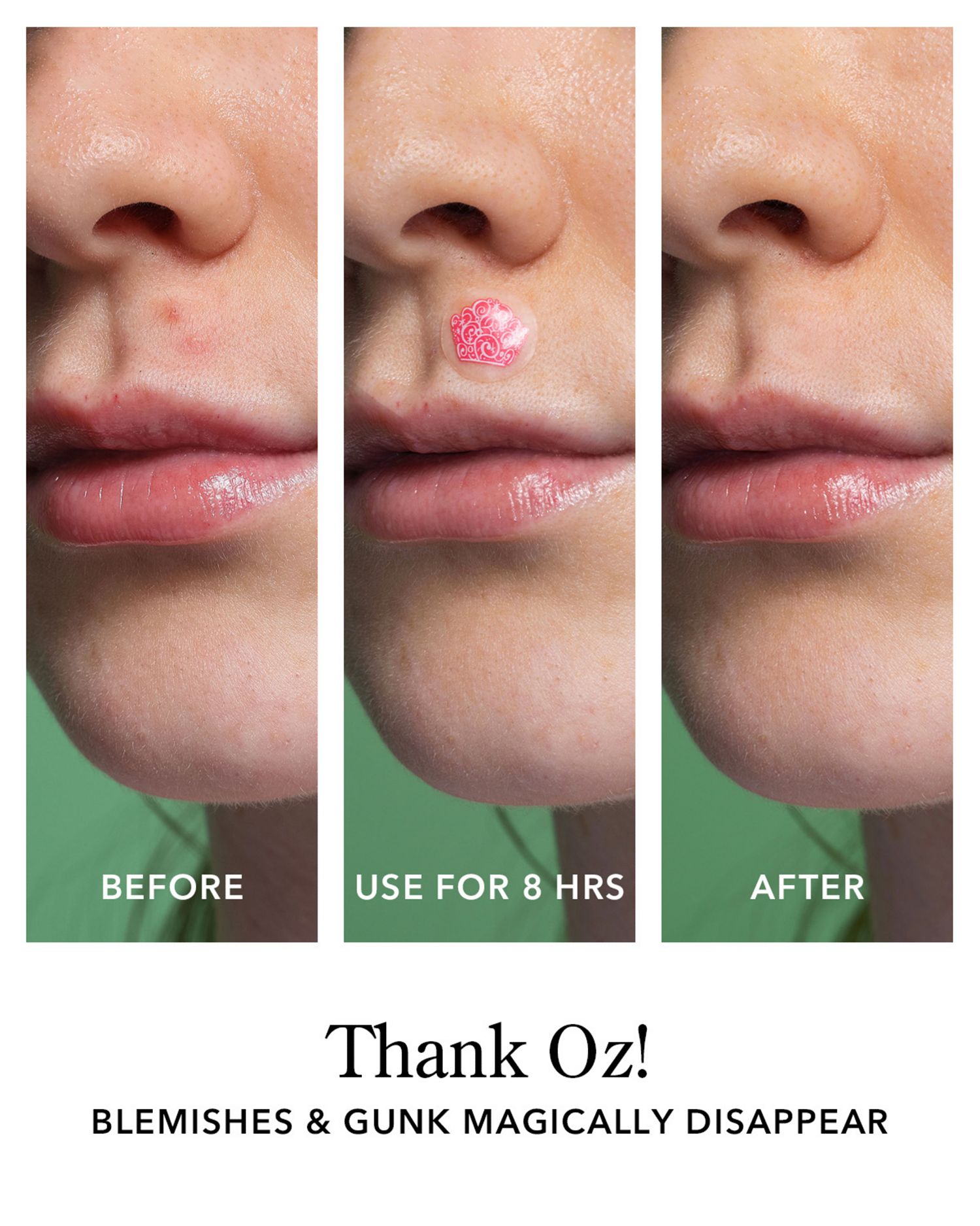 Beekman 1802 × Wicked Thank Oz! Blemish Patches (24 Count) - Image 5